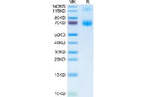 Mouse Fc Epsilon RI alpha/FCER1a on Tris-Bis PAGE under reduced condition. (Fc epsilon RI/FCER1A Protein (AA 24-204) (Fc Tag))