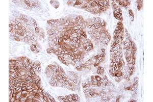 IHC-P Image Immunohistochemical analysis of paraffin-embedded SG xenograft , using CNGA2, antibody at 1:500 dilution. (CNGA2 antibody  (C-Term))