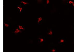 ABIN6269412 staining HeLa cells by IF/ICC.