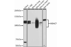 Western blot analysis of extracts of various cell lines, using HD Rabbit mAb (ABIN7267712) at 1:1000 dilution. (HDAC7 antibody)
