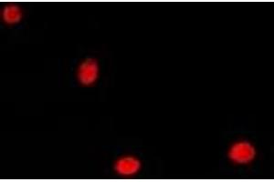 Immunofluorescent analysis of HDGF staining in A549 cells. (HDGF antibody)