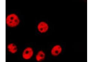 ABIN6266826 staining Hela by IF/ICC. (SKP2 antibody  (C-Term))