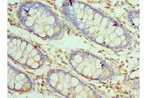 Immunohistochemistry of paraffin-embedded human colon tissue using ABIN7146923 at dilution of 1:100
