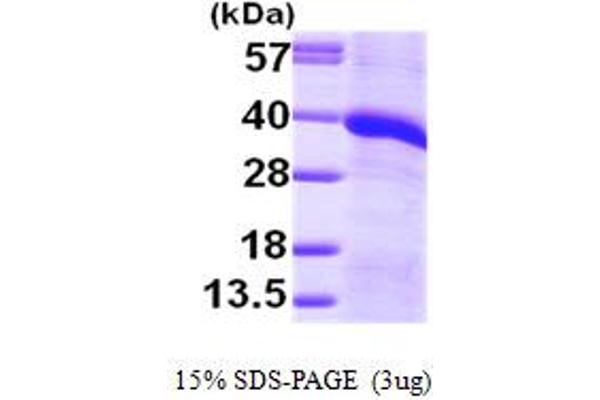 MGLL Protein (AA 1-313) (His tag)