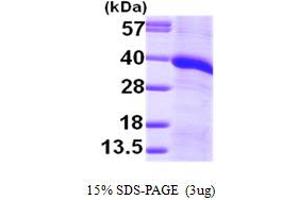 SDS-PAGE (SDS) image for Monoglyceride Lipase (MGLL) (AA 1-313) protein (His tag) (ABIN7279205) (MGLL Protein (AA 1-313) (His tag))