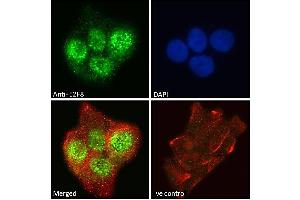 ABIN570707 Immunofluorescence analysis of paraformaldehyde fixed A431 cells, permeabilized with 0. (E2F8 antibody  (Internal Region))