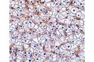 Immunohistochemistry (IHC) image for anti-Tumor Necrosis Factor Receptor Superfamily, Member 12A (TNFRSF12A) antibody (ABIN1031803)