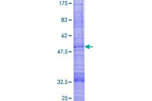 GOLT1B Protein (AA 1-138) (GST tag)