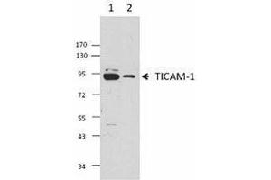 Western Blotting (WB) image for anti-Toll-Like Receptor Adaptor Molecule 1 (TICAM1) antibody (ABIN2665411) (TICAM1 antibody)