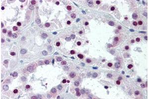 Human Kidney (formalin-fixed, paraffin-embedded) stained with SFRS1 antibody ABIN337068 at 5 ug/ml followed by biotinylated anti-mouse IgG secondary antibody ABIN481714, alkaline phosphatase-streptavidin and chromogen. (SRSF1 antibody  (N-Term))
