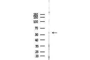 Western blot analysis of lysates from F10-LUC cells(heat-shock 45 min treatment), using FSCN2 Antibody at 1/1000 dilution.