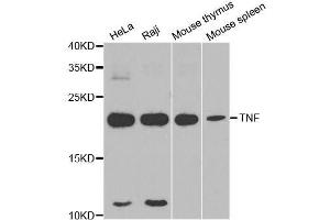 Western blot analysis of extracts of various cell lines, using TNF-α antibody. (TNF alpha antibody)