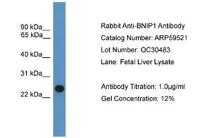 WB Suggested Anti-BNIP1  Antibody Titration: 0. (BNIP1 antibody  (C-Term))