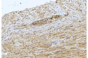 ABIN6277512 at 1/100 staining Mouse muscle tissue by IHC-P.