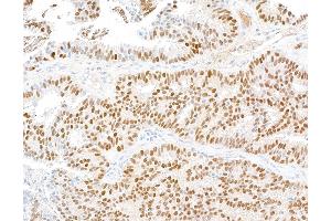 anti-Estrogen Receptor 1 (ESR1) antibody