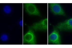 Detection of COX4I1 in Human Hela cell using Polyclonal Antibody to Cytochrome C Oxidase Subunit IV Isoform 1 (COX4I1) (COX IV antibody  (AA 1-169))