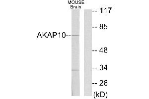 Western blot analysis of extracts from mouse brain cells, using AKAP10 antibody. (AKAP10 antibody  (Internal Region))