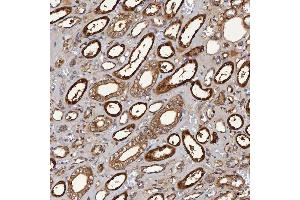 IHC analysis of SBP/SELENBP1 using anti-SBP/SELENBP1 antibody (ABIN7600755). (SELENBP1 antibody  (AA 23-462))
