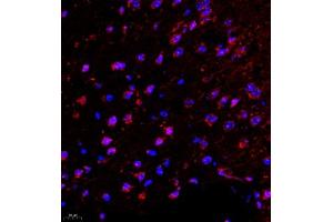 Immunofluorescence of paraffin embedded mouse brain using SRP14 (ABIN7075596) at dilution of 1:300 (400x lens) (SRP14 antibody)