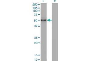 Western Blot analysis of ZSCAN21 expression in transfected 293T cell line by ZNF38 monoclonal antibody (M16), clone 4F10. (ZSCAN21 antibody  (AA 136-224))