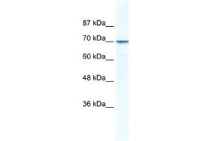 WB Suggested Anti-LAS1L Antibody Titration: 0. (LAS1L antibody  (Middle Region))