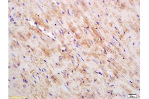 Formalin-fixed and paraffin embedded mouse heart labeled with Rabbit Anti CKMT/Creatine kinase MT Polyclonal Antibody, Unconjugated (ABIN717536) at 1:200 followed by conjugation to the secondary antibody and DAB staining (CKMT1B antibody  (AA 115-220))