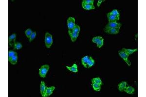 Immunofluorescent analysis of HepG2 cells using ABIN7157042 at dilution of 1:100 and Alexa Fluor 488-congugated AffiniPure Goat Anti-Rabbit IgG(H+L) (IRF3 antibody  (AA 1-452))