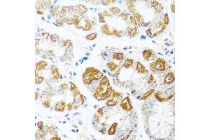 Immunohistochemistry of paraffin-embedded human stomach using CCL2 antibody (ABIN4903158) at dilution of 1:100 (40x lens). (CCL2 antibody)
