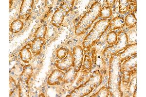 ABIN6256606 and ABIN6268850 at 1/100 staining Rat kidney tissue by IHC-P. (DCT antibody  (N-Term))