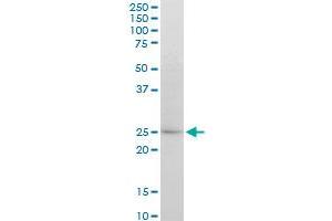 ATG5 monoclonal antibody (M04), clone 1G11. (ATG5 antibody  (AA 176-275))