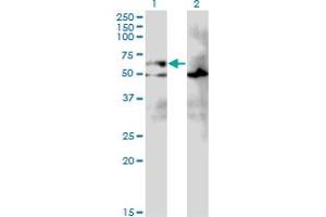 Western Blot analysis of EIF2A expression in transfected 293T cell line by EIF2A monoclonal antibody (M01), clone 3D5. (EIF2A antibody  (AA 1-100))