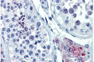 Human Testis (formalin-fixed, paraffin-embedded) stained with ASH2L antibody ABIN462194 followed by biotinylated goat anti-rabbit IgG secondary antibody ABIN481713, alkaline phosphatase-streptavidin and chromogen. (ASH2L antibody  (AA 288-337))
