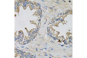 Immunohistochemistry (Paraffin-embedded Sections) (IHC (p)) image for anti-Eukaryotic Translation Initiation Factor 3 Subunit H (EIF3H) (AA 80-340) antibody (ABIN6140064)