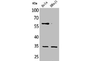 Western Blot analysis of HeLa Raji cells using CD32 Polyclonal Antibody (FCGR2B antibody  (C-Term))