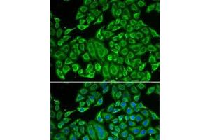 Immunofluorescence analysis of MCF7 cells using IL12RB1 Polyclonal Antibody (IL12RB1 antibody)