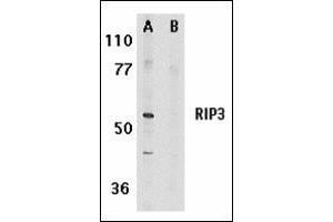 Western blot analysis of RIP3 in mouse 3T3 whole cell lysate in the absence (A) or presence (B) of blocking peptide with RIP3 antibody at 1 μg/ml.