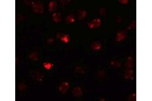 Immunofluorescencent staining of 3T3 cells with PIWIL3 polyclonal antibody  at 20 ug/mL.
