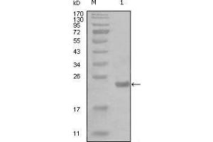 Western blot analysis using CHUK mouse mAb against truncated Trx-CHUK recombinant protein (1). (IKK alpha antibody  (AA 500-590))