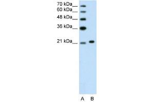 Ankyrin 1 antibody used at 1. (Erythrocyte Ankyrin antibody  (C-Term))