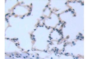 Immunohistochemistry (IHC) image for anti-Interleukin 6 (IL6) (AA 21-211) antibody (ABIN7427093)