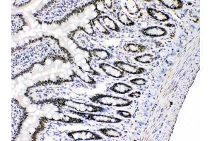 Immunohistochemistry (IHC) image for anti-E2F Transcription Factor 4, P107/p130-Binding (E2F4) (AA 106-144), (N-Term) antibody (ABIN4886566)