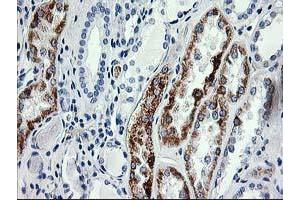 Immunohistochemical staining of paraffin-embedded Human Kidney tissue using anti-AK4 mouse monoclonal antibody. (AK4 antibody)