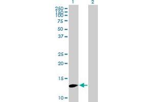 Western Blot analysis of FBXW9 expression in transfected 293T cell line by FBXW9 MaxPab polyclonal antibody. (FBXW9 antibody  (AA 1-135))