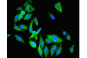 Immunofluorescent analysis of Hela cells using ABIN7145489 at dilution of 1:100 and Alexa Fluor 488-congugated AffiniPure Goat Anti-Rabbit IgG(H+L) (ENO3 antibody  (AA 7-432))