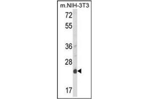 Western blot analysis of DERL1 Antibody (C-term) Cat. (DERL1 antibody  (C-Term))