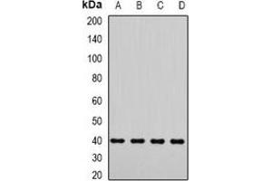 Western blot analysis of LIC3 expression in Jurkat (A), A549 (B), mouse testis (C), rat testis (D) whole cell lysates. (DYNC2LI1 antibody)