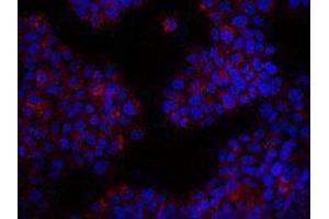 Immunofluorescence (IF) image for anti-Receptor Tyrosine-Protein Kinase ErbB-3 (ERBB3) antibody (ABIN2664957) (ERBB3 antibody)