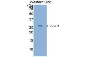 Detection of Recombinant GKN2, Mouse using Polyclonal Antibody to Gastrokine 2 (GKN2) (Gastrokine 2 antibody  (AA 21-184))
