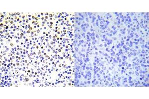 Immunohistochemical analysis of paraffin- embedded human malignant lymphoma tissue using Histone H3.
