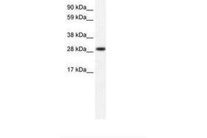 Image no. 1 for anti-Four and A Half LIM Domains 1 (FHL1) (AA 207-256) antibody (ABIN202152) (FHL1 antibody  (AA 207-256))